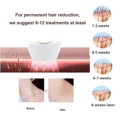 Ipl Hair Removal Laser Device